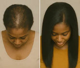 Before and after Hair growth