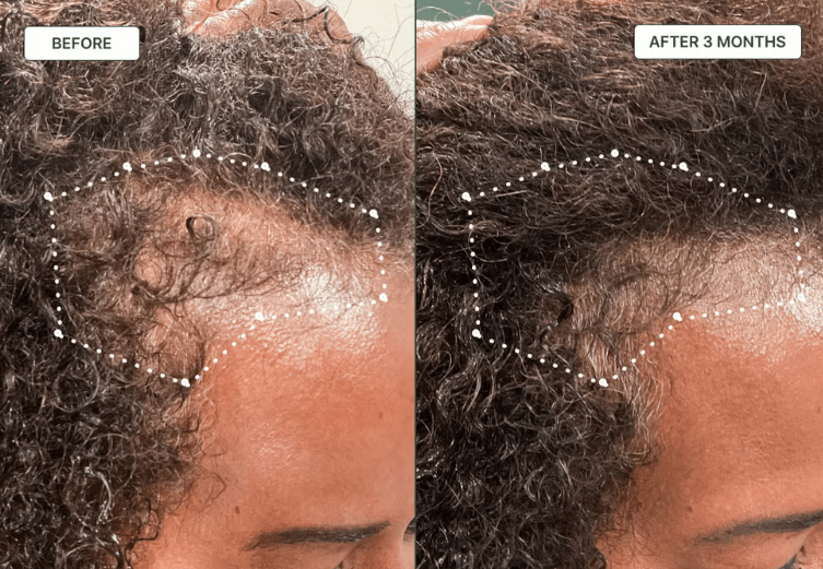 Caffeine Hair Growth Oil to Promote Healthy Hair | Natural