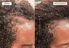 Caffeine Hair Growth Oil to Promote Healthy Hair | Natural