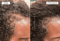 Hair Growth Oil with Caffeine, Rosemary, and Peppermint Oil - 3.4 Fl. Oz - Seddy