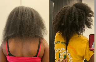 Before and after Hair growth