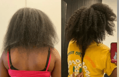 Before and after Hair growth