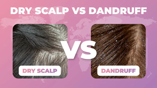 Dry scalp vs dandruff: Difference, Causes and Treatment – Cosmetic World