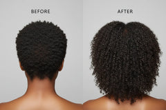 Ultimate Hair Renewal Bundle — Grow. Nourish. Soothe. - Seddy