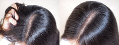 Seddy Itchy Scalp Relief - Hair Restoration